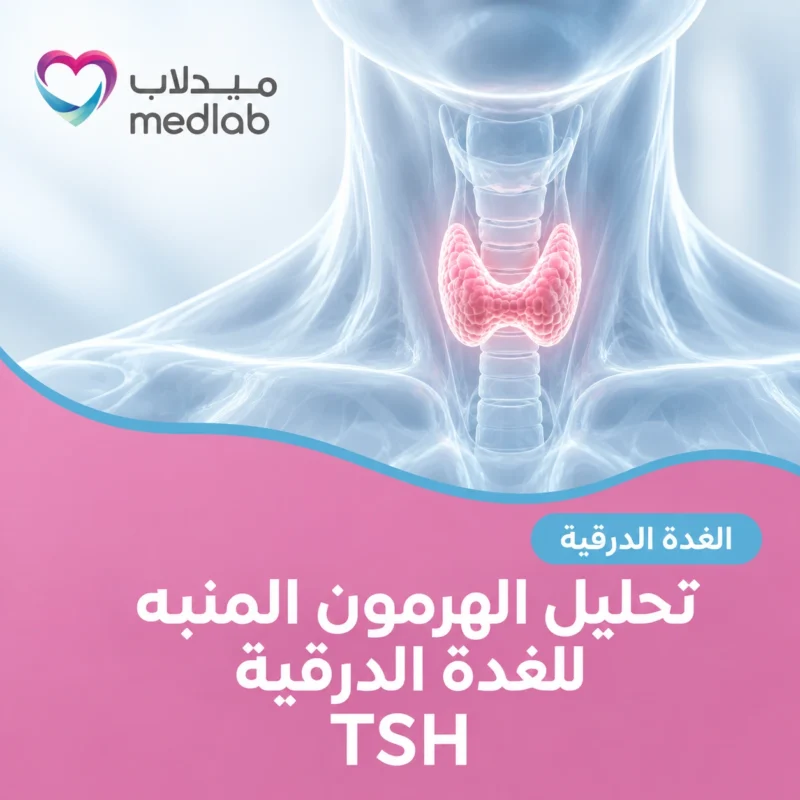 تحليل الهرمون المنبه للغدة الدرقية (TSH)