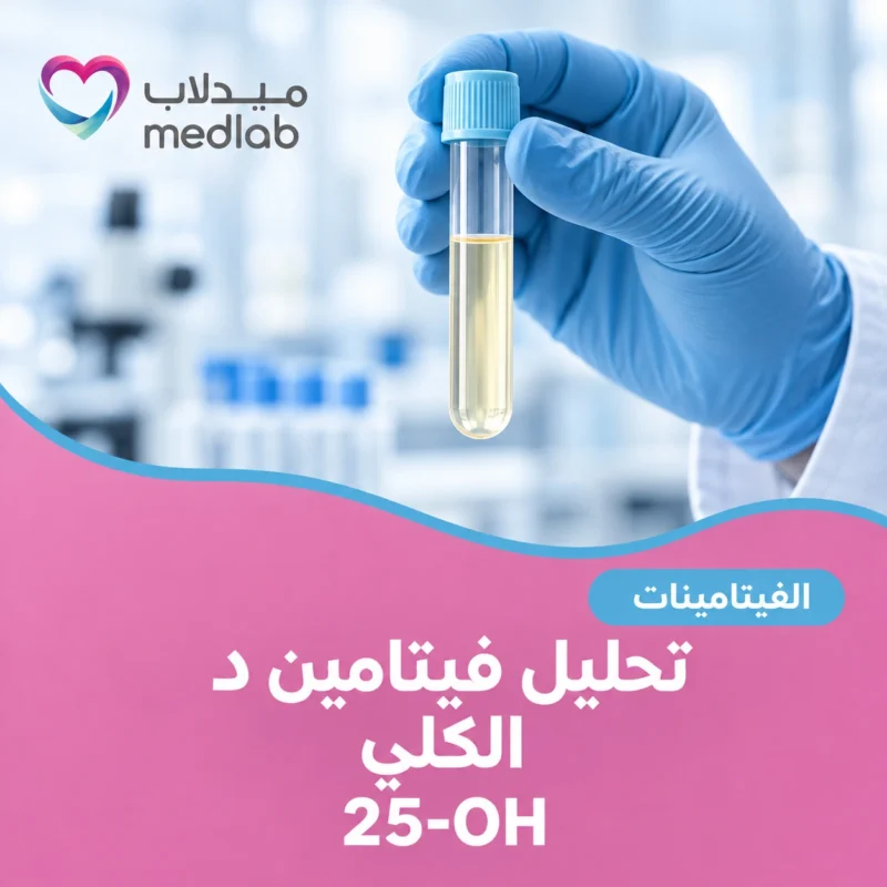 تحليل فيتامين د الكلي (25-OH)