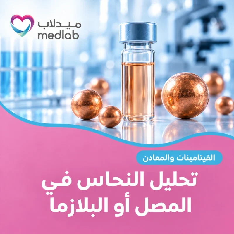 تحليل النحاس في المصل أو البلازما