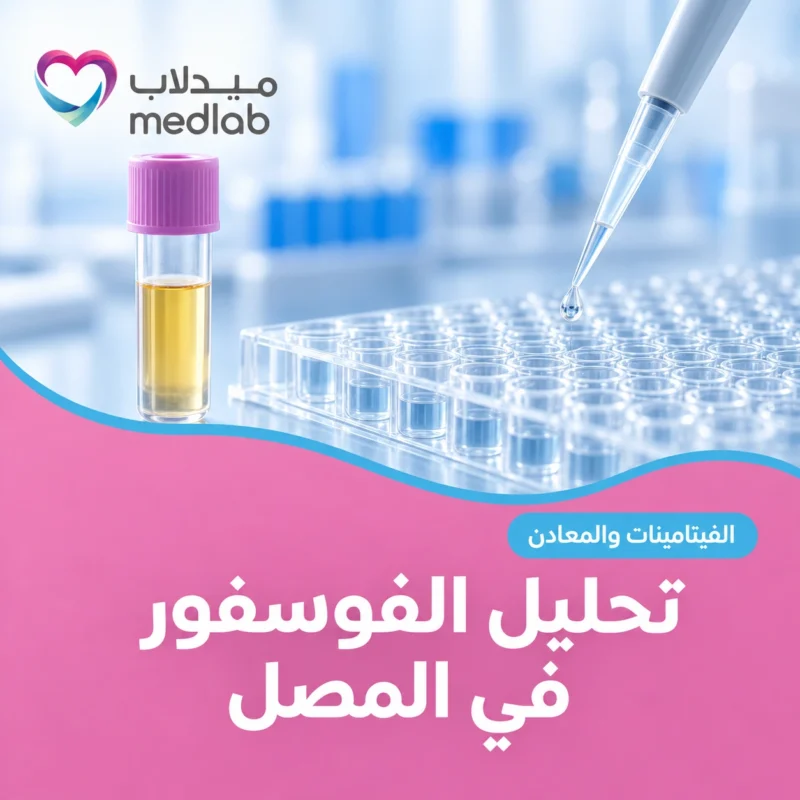 تحليل الفوسفور في المصل
