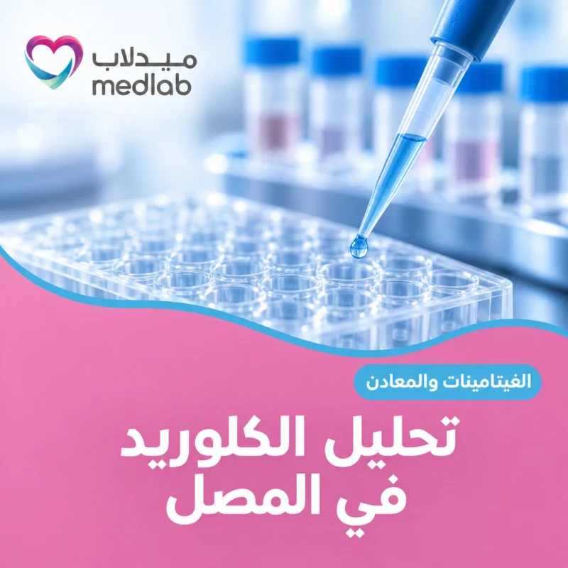 تحليل الكلوريد في المصل
