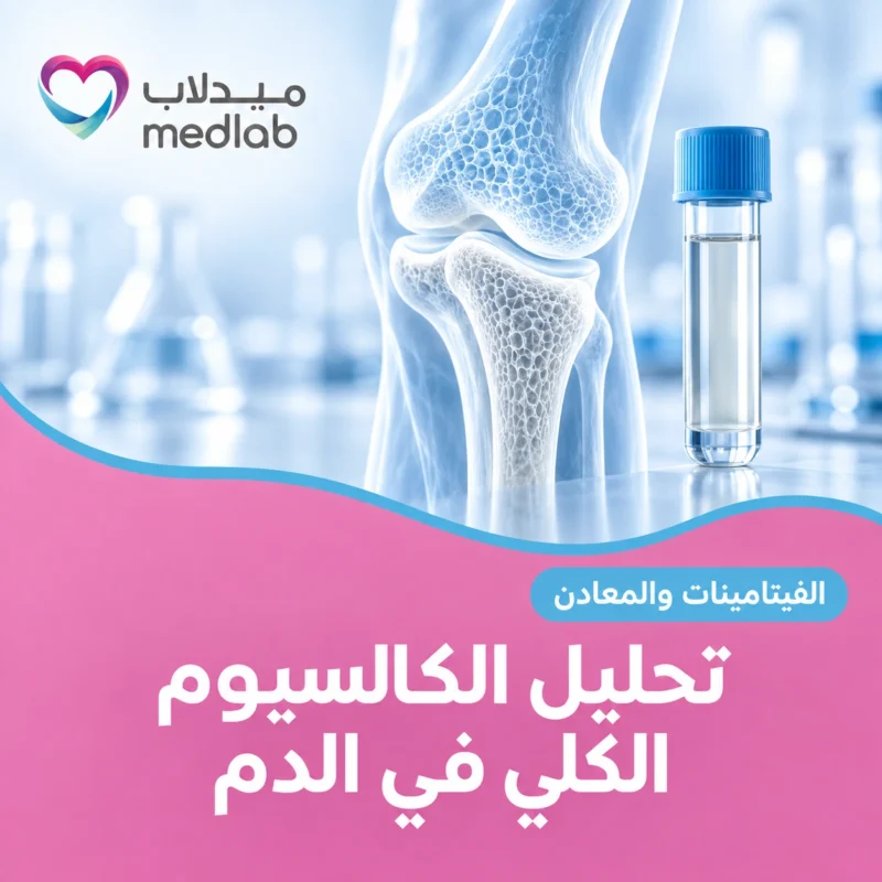 تحليل الكالسيوم الكلي في الدم