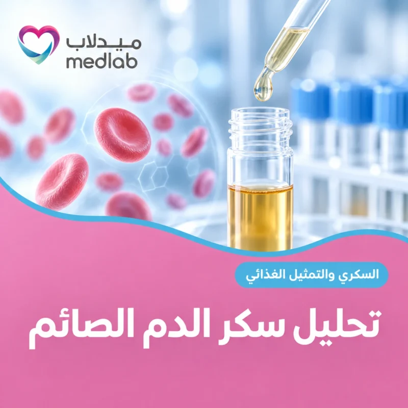 تحليل سكر الدم الصائم
