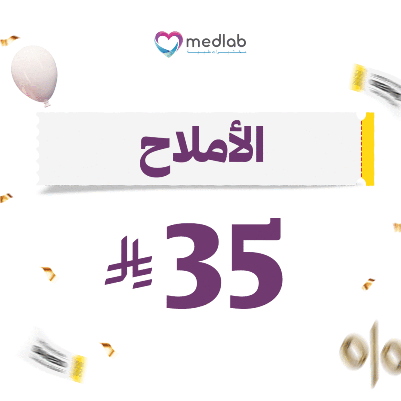 الأملاح Uric Acid