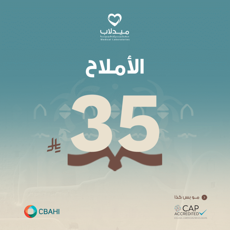 الأملاح Uric Acid