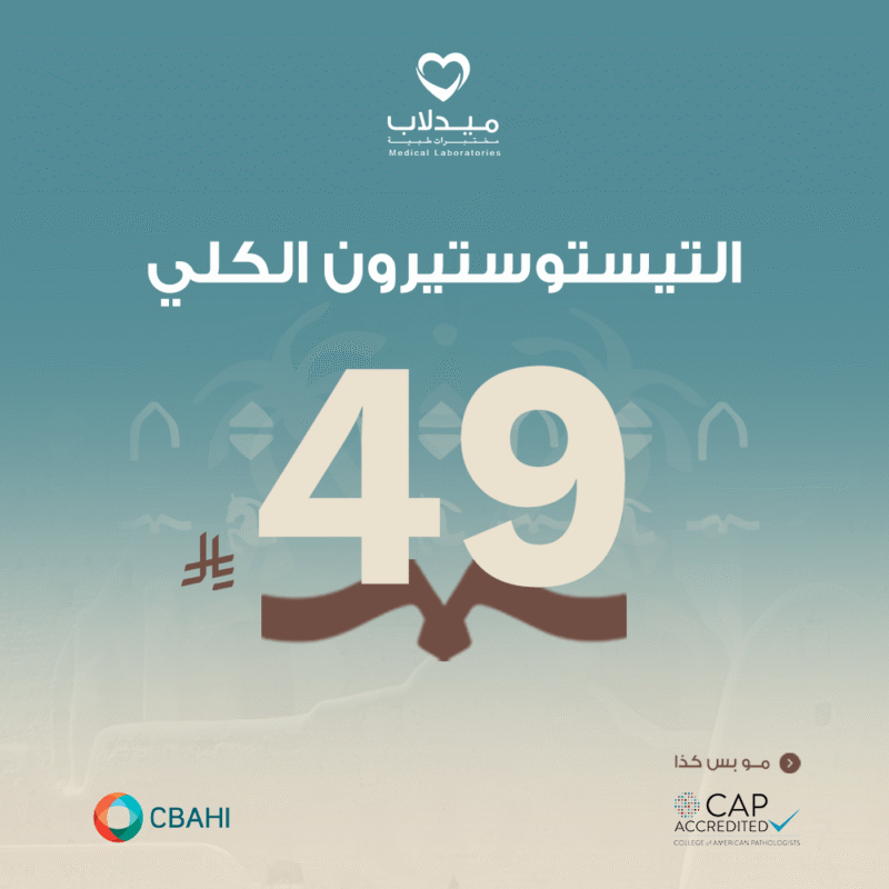 التيستوستيرون الكلي