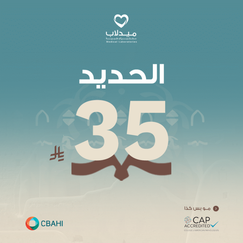 الحديد Iron (Fe)