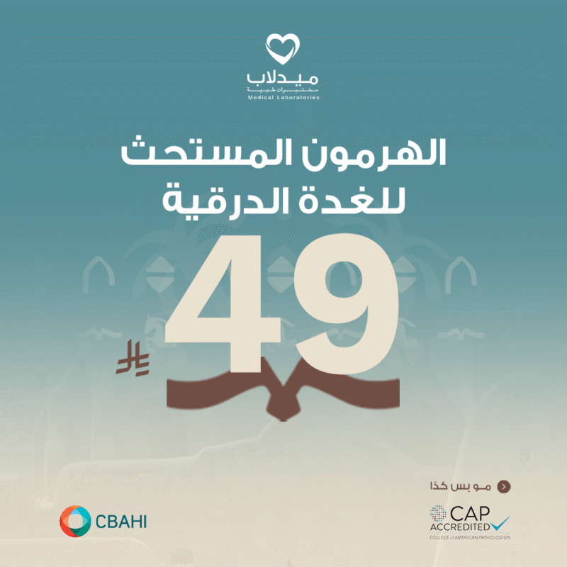 هرمون المستحث للغدة الدرقية TSH