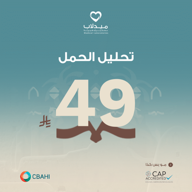 تحليل الحمل