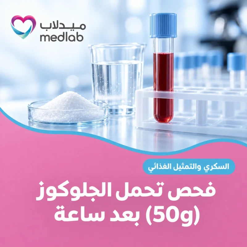 فحص تحمل الجلوكوز (50g) بعد ساعة