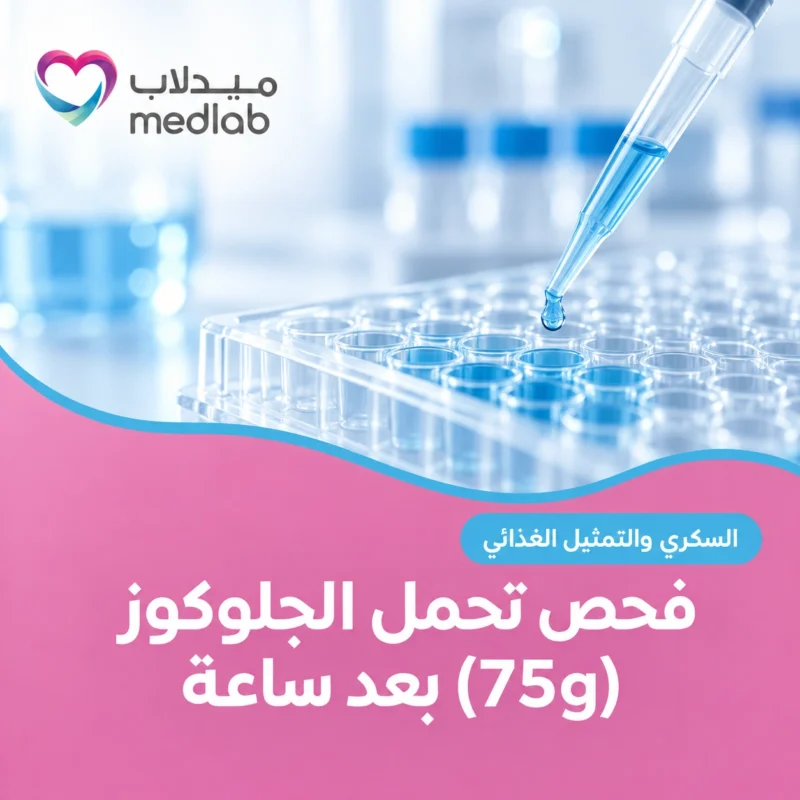 فحص تحمل الجلوكوز (75g) بعد ساعة