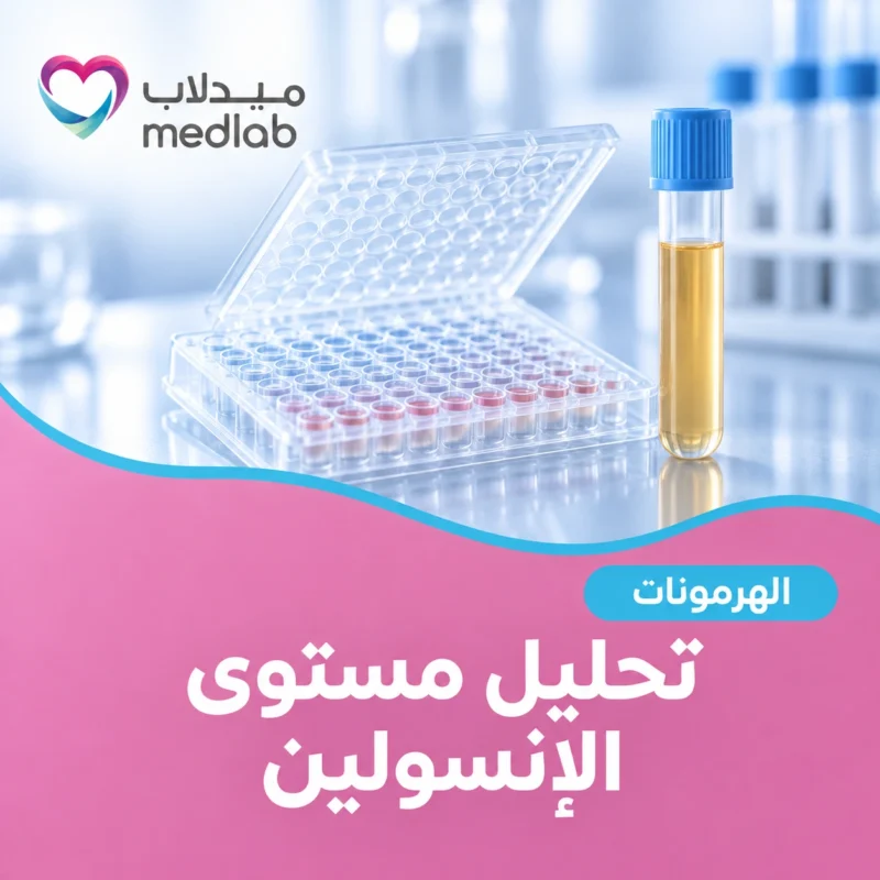 تحليل مستوى الإنسولين