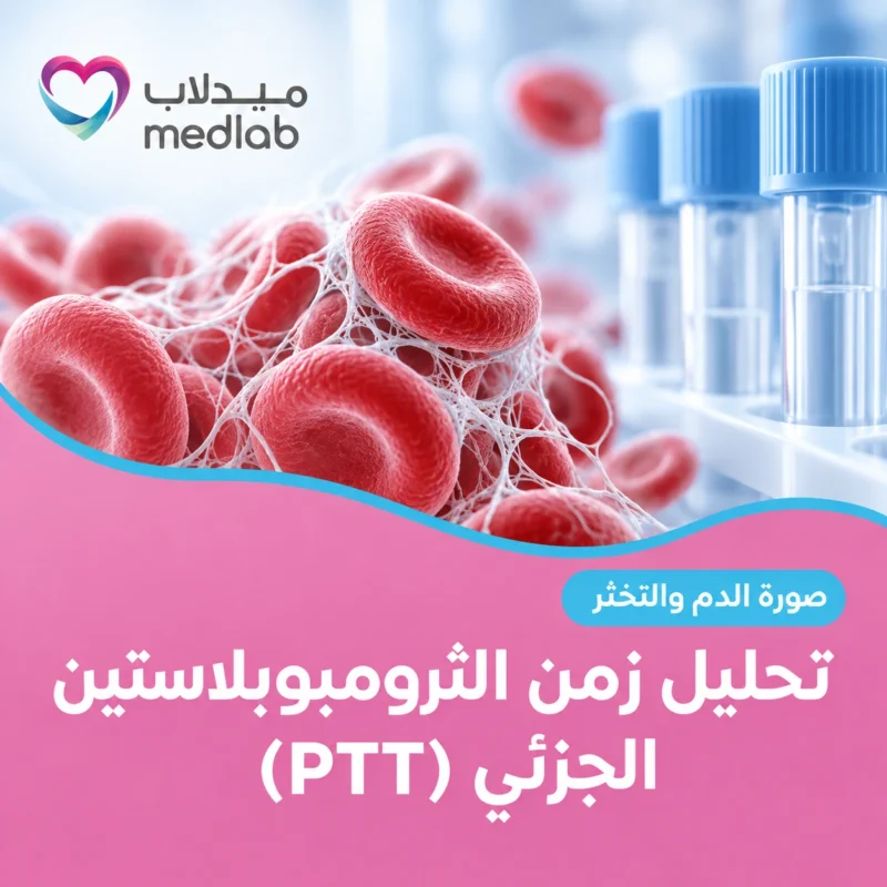 تحليل زمن الثرومبوبلاستين الجزئي (PTT)