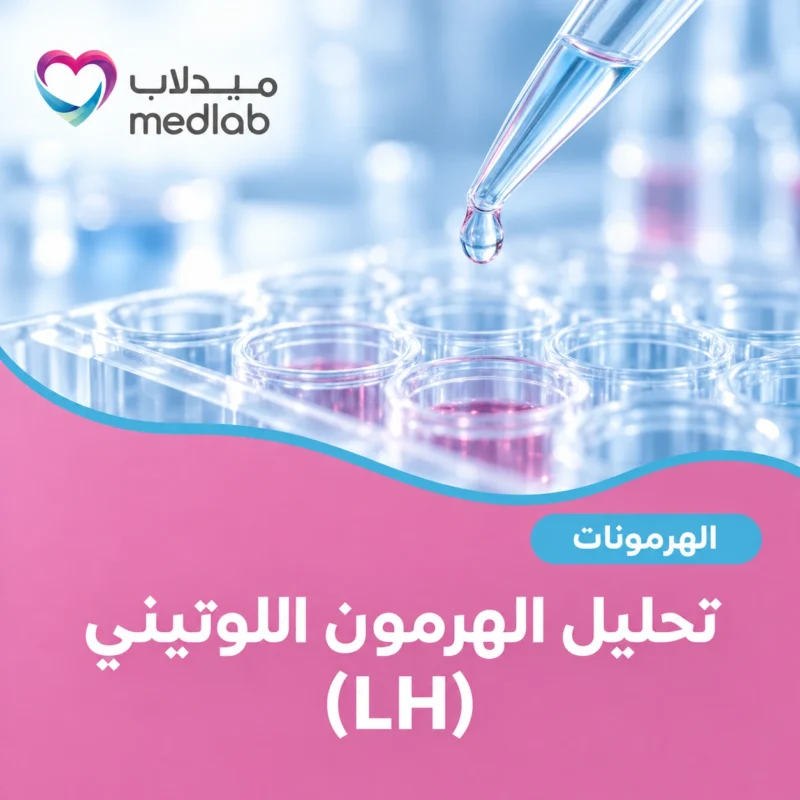 تحليل الهرمون اللوتيني (LH)