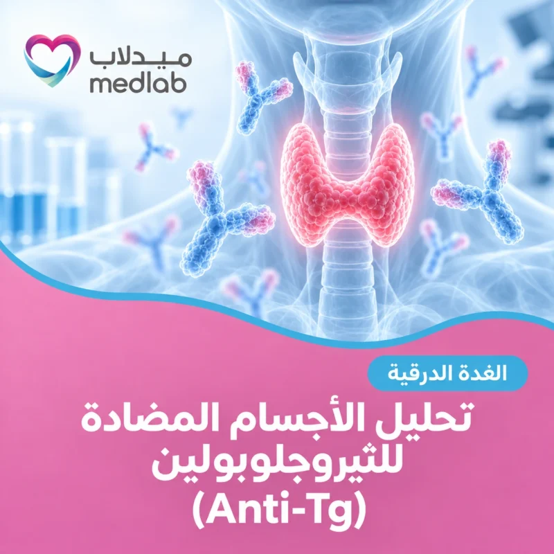 تحليل الأجسام المضادة للثيروجلوبولين (Anti-Tg)