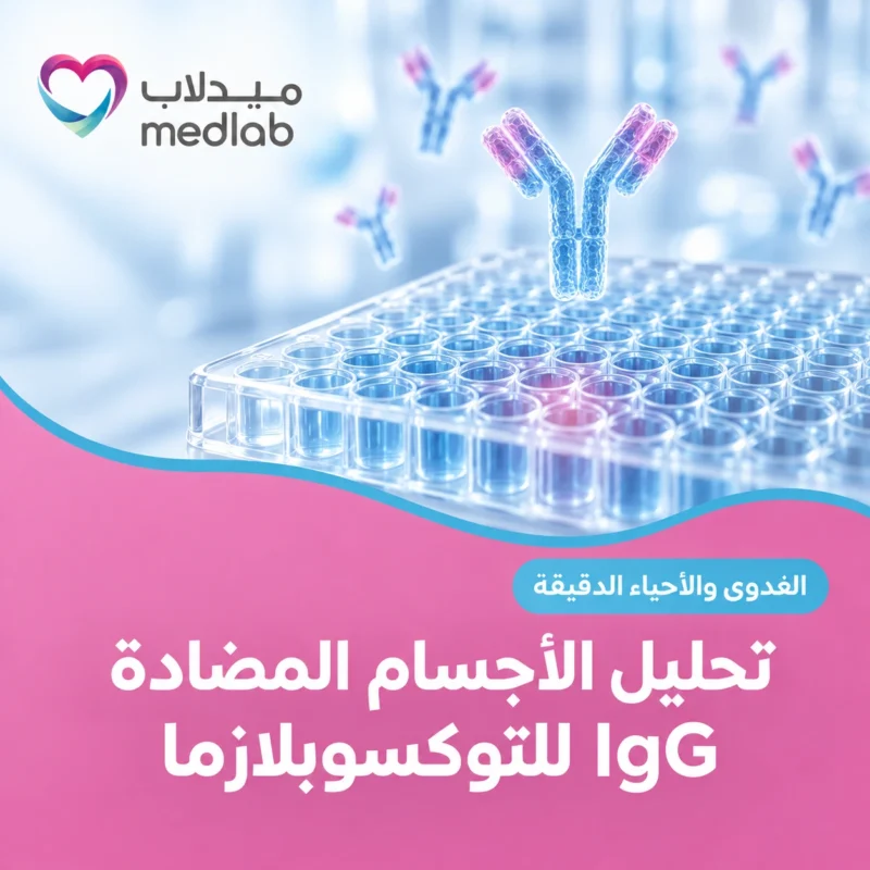 تحليل الأجسام المضادة IgG للتوكسوبلازما