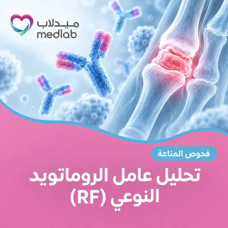 تحليل عامل الروماتويد النوعي (RF)