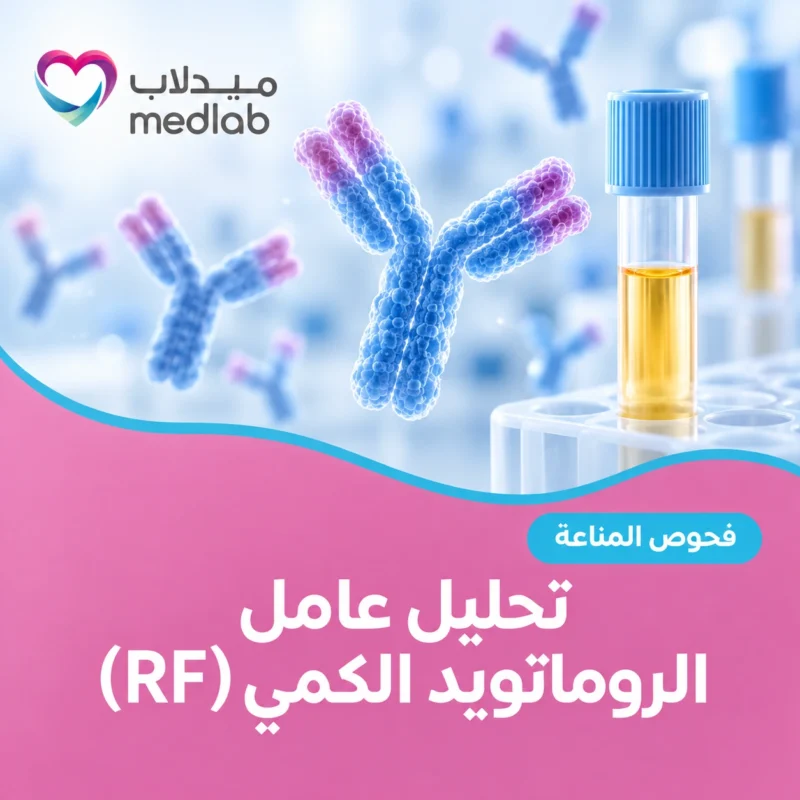 تحليل عامل الروماتويد الكمي (RF)