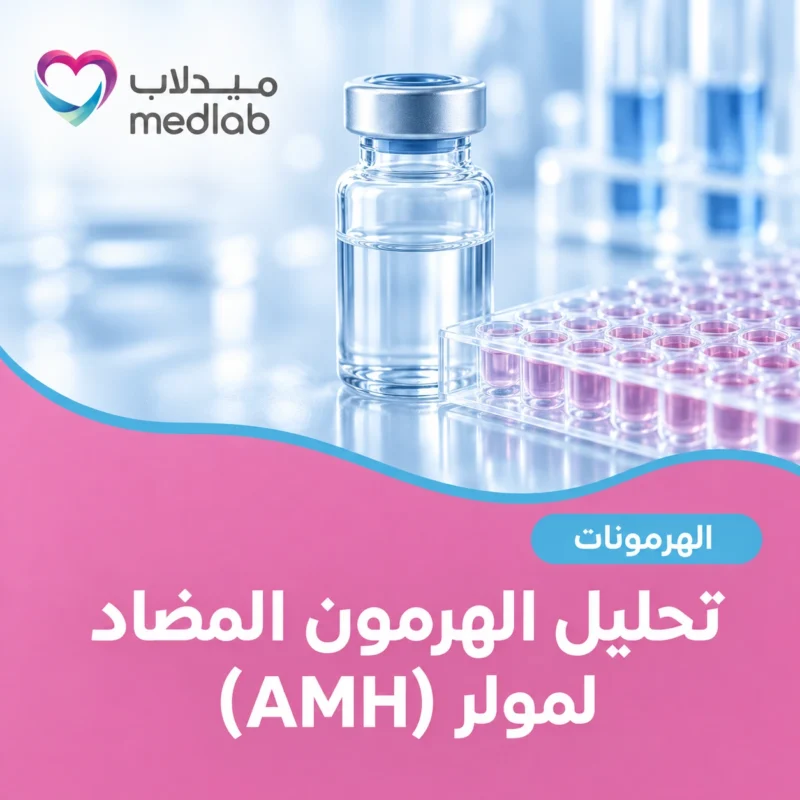 تحليل الهرمون المضاد لمولر (AMH)