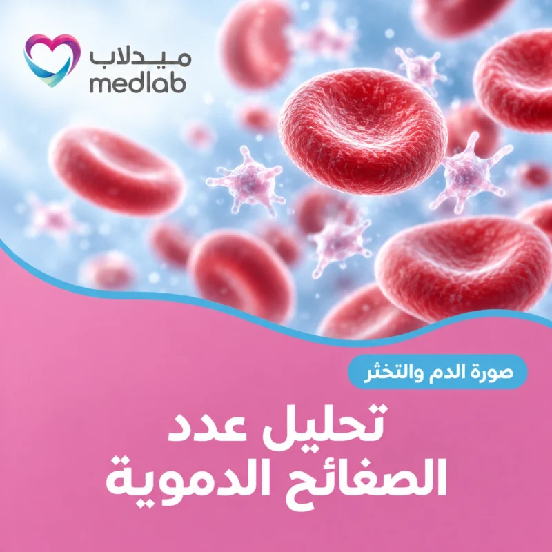 تحليل عدد الصفائح الدموية