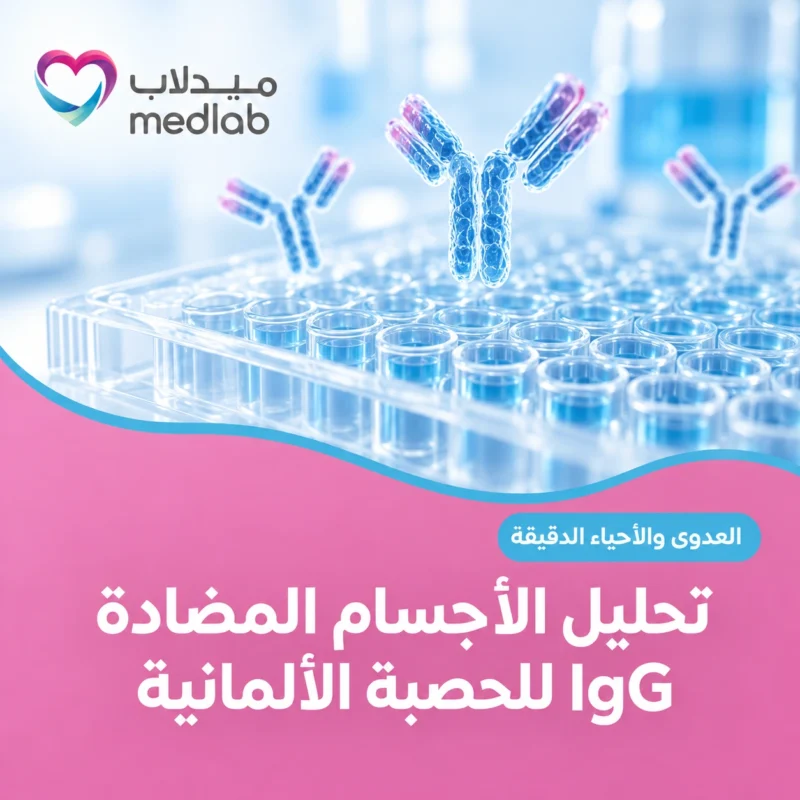 تحليل الأجسام المضادة IgG للحصبة الألمانية