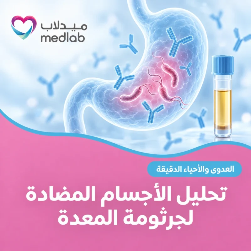 تحليل الأجسام المضادة لجرثومة المعدة