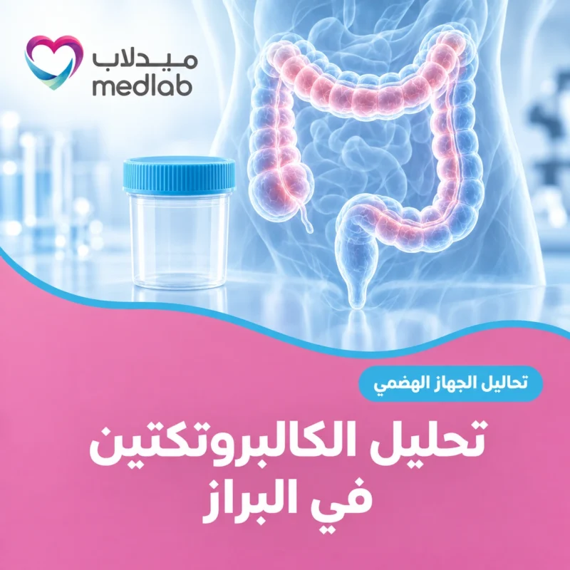 تحليل الكالبروتكتين في البراز