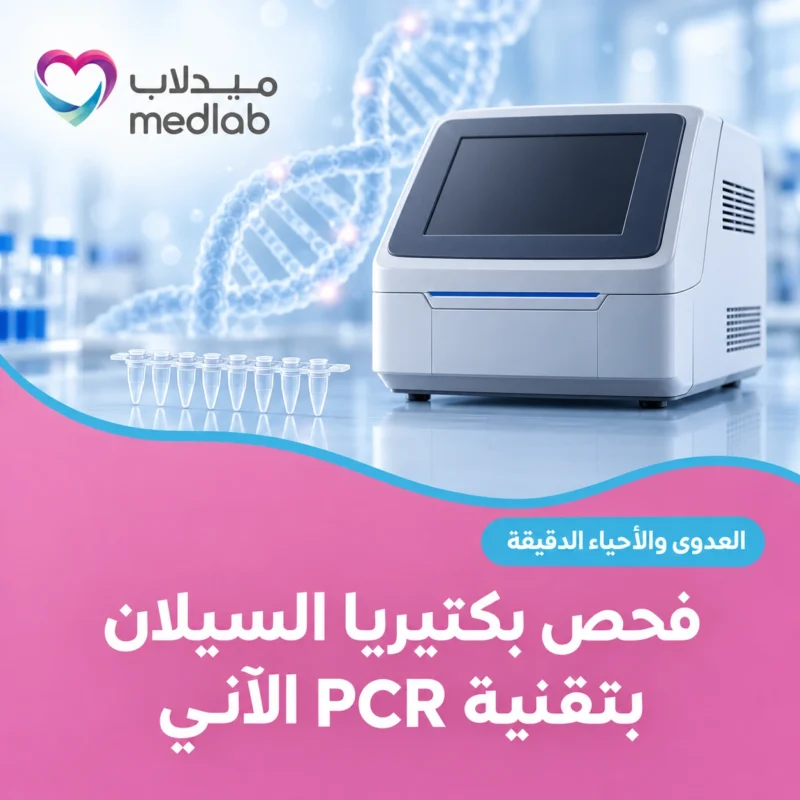 فحص بكتيريا السيلان بتقنية PCR الآني