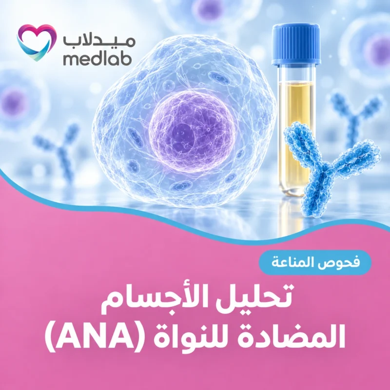 تحليل الأجسام المضادة للنواة (ANA)