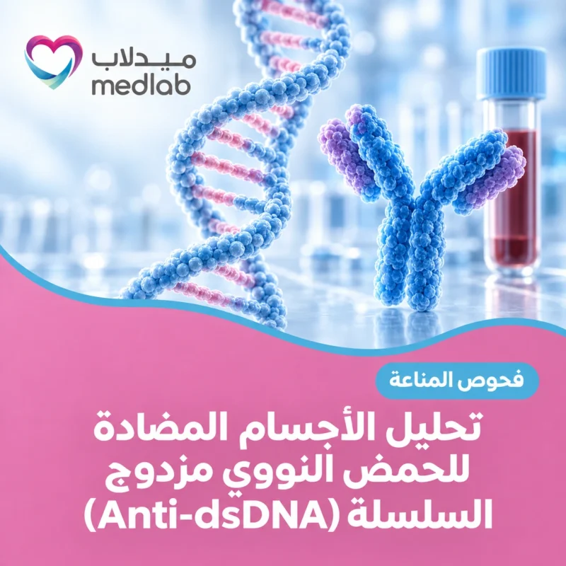 تحليل الأجسام المضادة للحمض النووي مزدوج السلسلة (Anti-dsDNA)