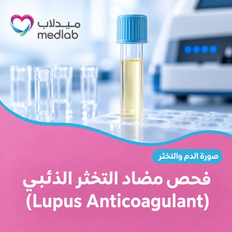 فحص مضاد التخثر الذئبي (Lupus Anticoagulant)