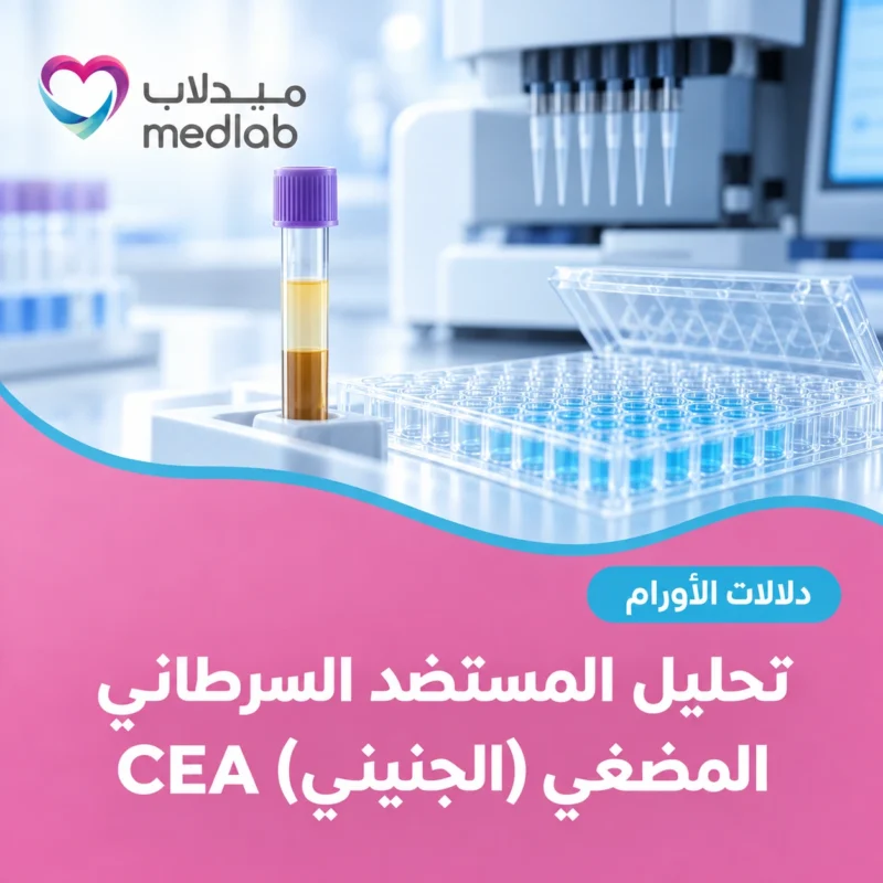 تحليل المستضد السرطاني المضغي (الجنيني) CEA