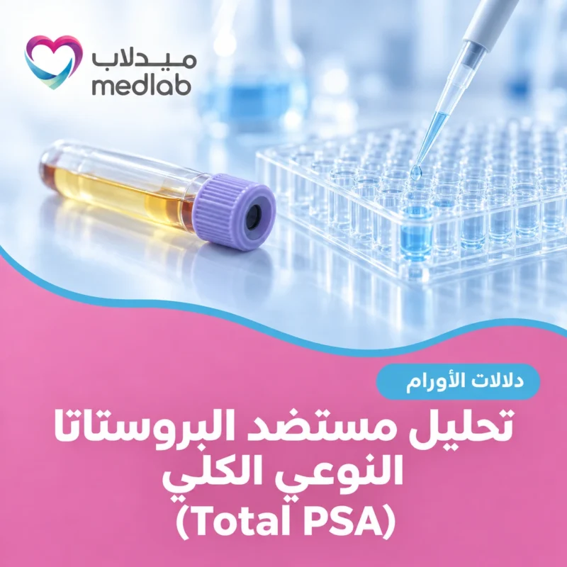 تحليل مستضد البروستاتا النوعي الكلي (Total PSA)
