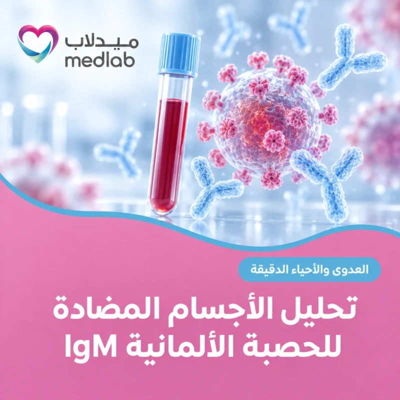 تحليل الأجسام المضادة للحصبة الألمانية IgM