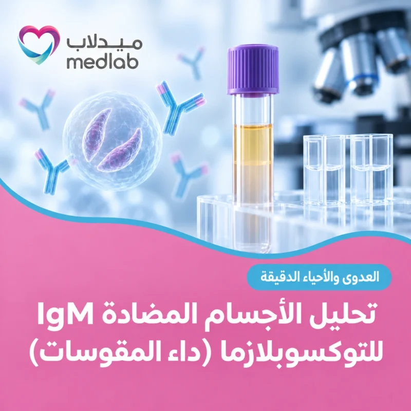 تحليل الأجسام المضادة IgM للتوكسوبلازما (داء المقوسات)