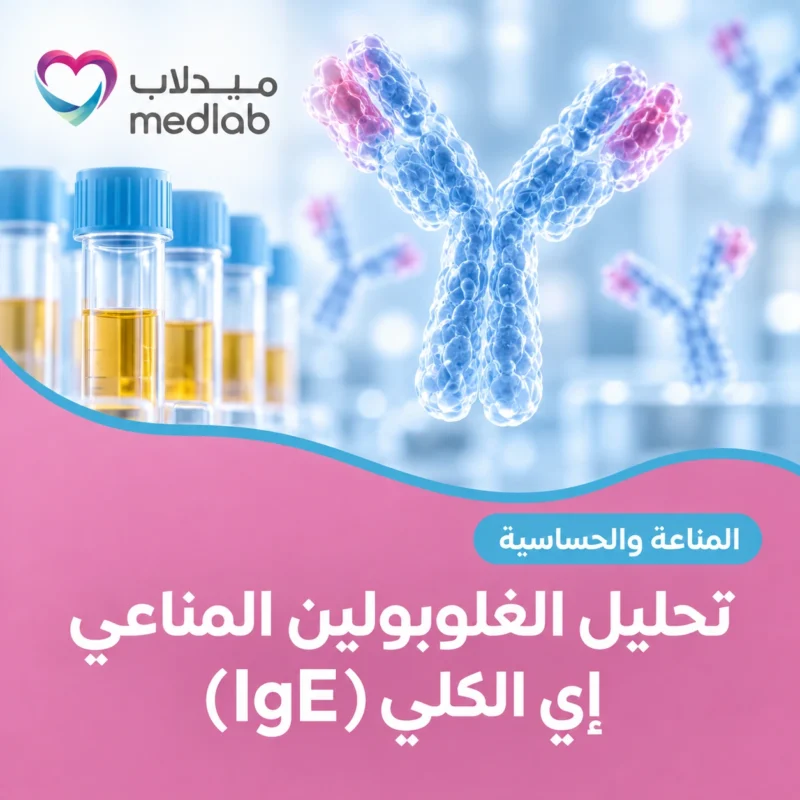تحليل الغلوبولين المناعي إي الكلي (IgE)