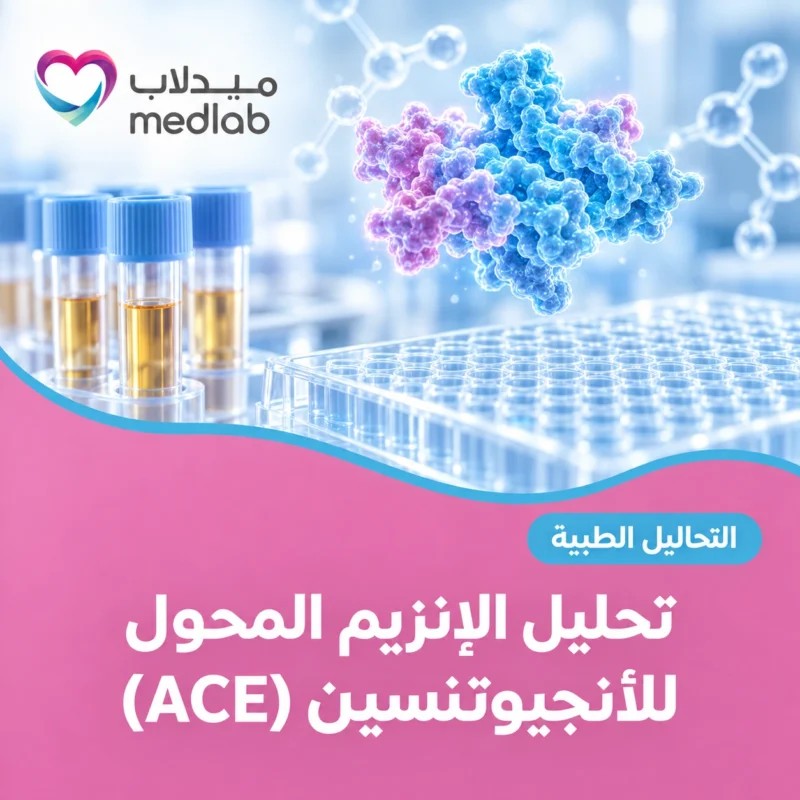 تحليل الإنزيم المحول للأنجيوتنسين (ACE)