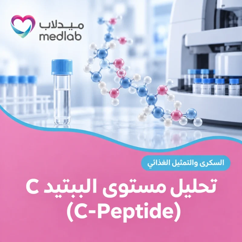 تحليل مستوى الببتيد C (C-Peptide)