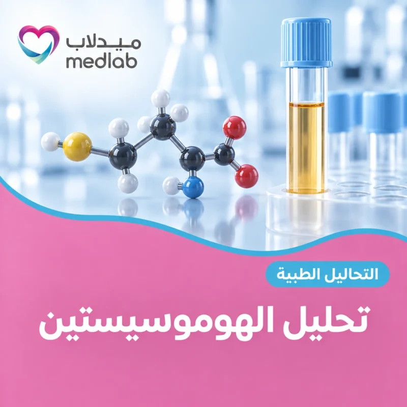 تحليل الهوموسيستين