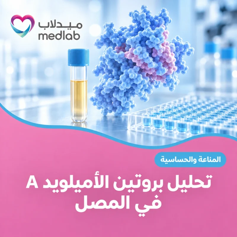تحليل بروتين الأميلويد A في المصل