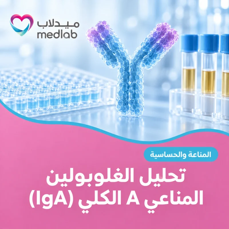تحليل الغلوبولين المناعي A الكلي (IgA)
