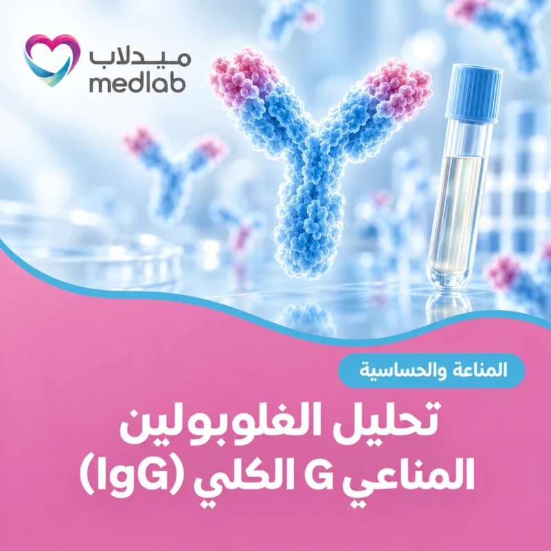 تحليل الغلوبولين المناعي G الكلي (IgG)