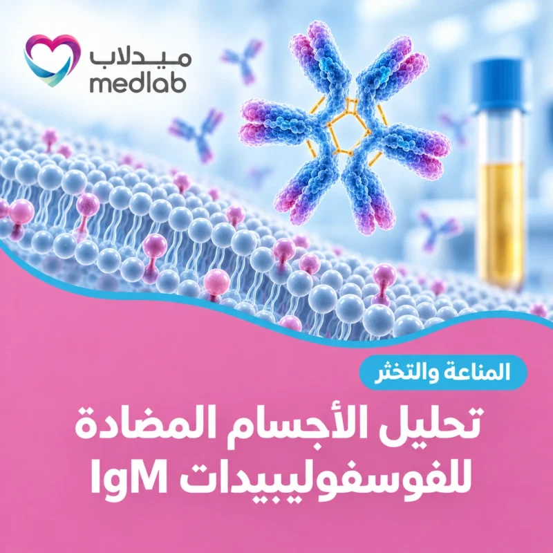تحليل الأجسام المضادة للفوسفوليبيدات IgM