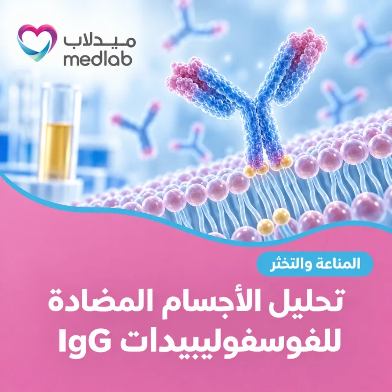 تحليل الأجسام المضادة للفوسفوليبيدات IgG