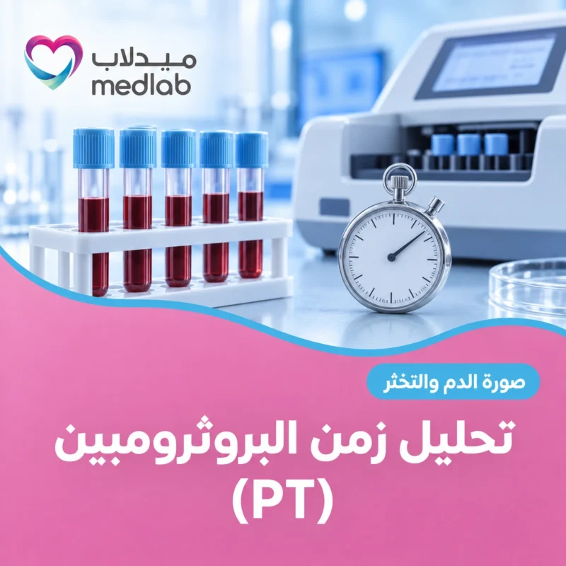 تحليل زمن البروثرومبين (PT)