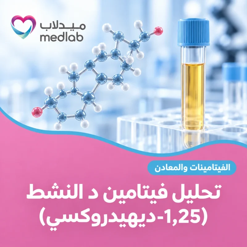 تحليل فيتامين د النشط (1,25-ديهيدروكسي)