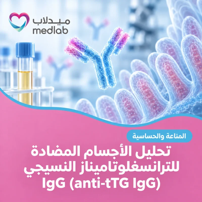 تحليل الأجسام المضادة للترانسغلوتاميناز النسيجي IgG (anti-tTG IgG)