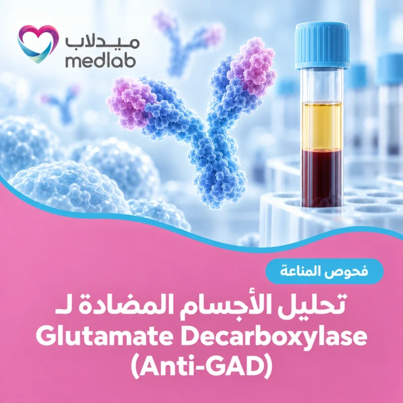 تحليل الأجسام المضادة لـGlutamate Decarboxylase (Anti-GAD)