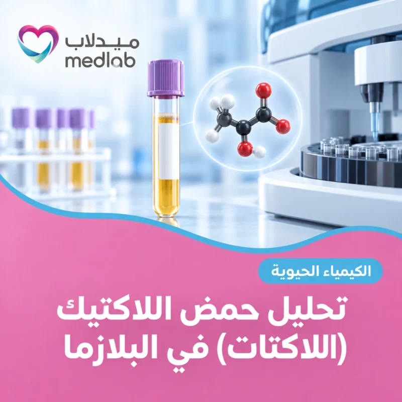تحليل حمض اللاكتيك (اللاكتات) في البلازما