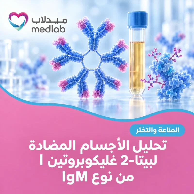 تحليل الأجسام المضادة لبيتا-2 غليكوبروتين I من نوع IgM